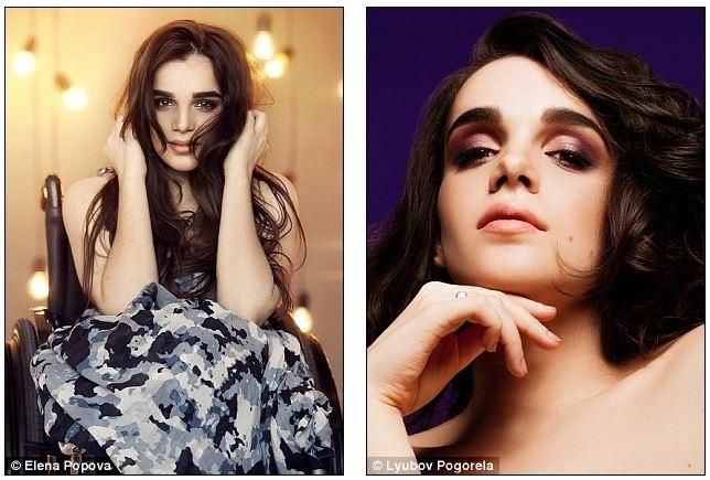 Про українську модель на візку пишуть світові таблоїди Про українську модель на візку пишуть світові таблоїди