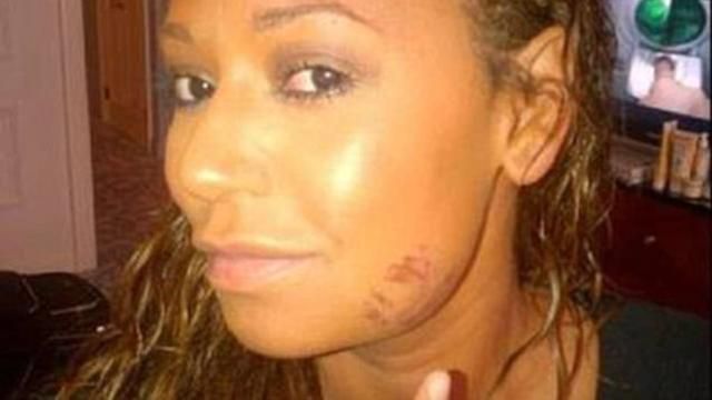 Скандальне розлучення: екс-учасниця Spice Girls розповіла про знущання чоловіка Скандальне розлучення: екс-учасниця Spice Girls розповіла про знущання чоловіка