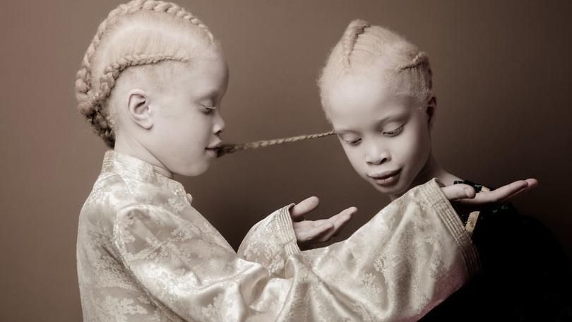 Неймовірна краса: як дівчата-альбіноси підкорюють мережу своїми фото