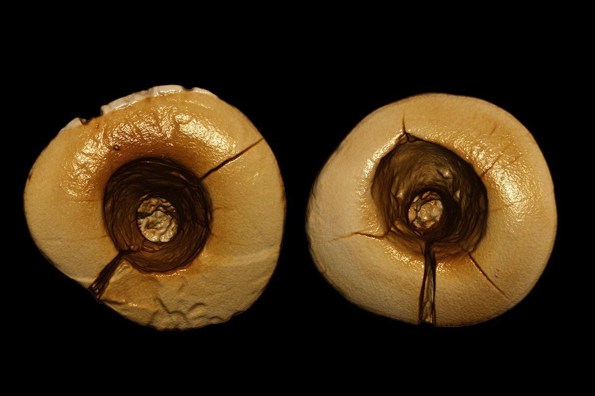 Археологи знайшли зубні пломби, яким більше 13 тисяч років