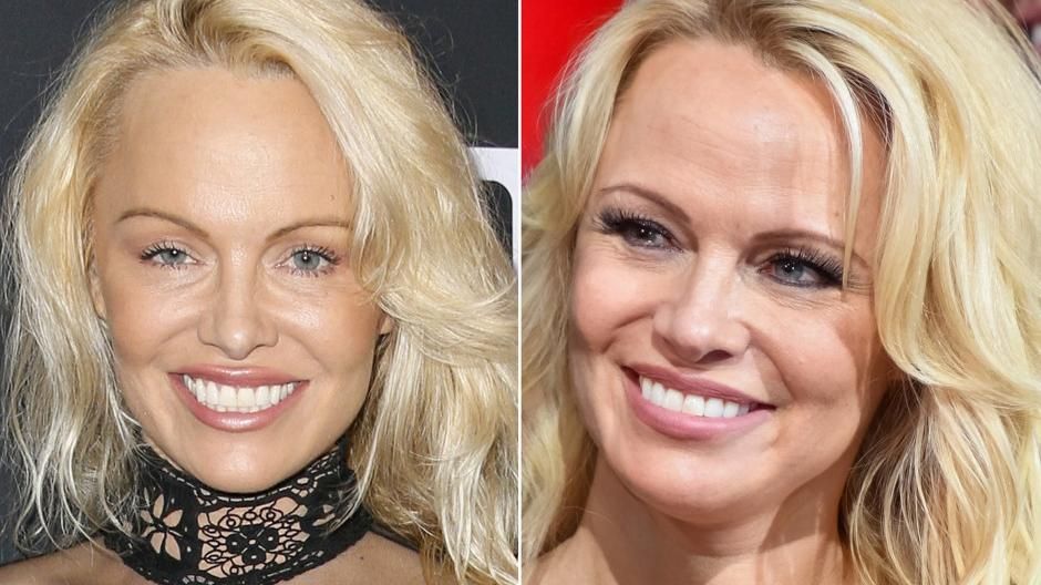 Как изменился секс-символ Памела Андерсон: шокирующее фотосравнение Как изменился секс-символ Памела Андерсон: шокирующее фотосравнение