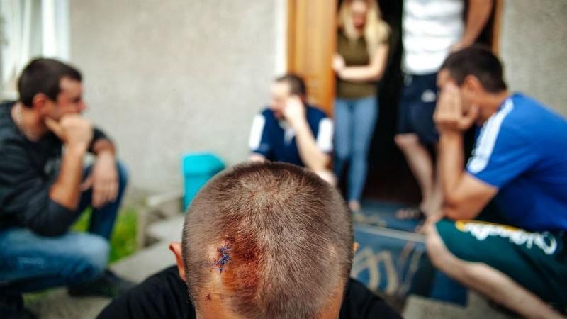 Польща для поляків – українських заробітчан побили у Ґданську Польща для поляків – українських заробітчан побили у Ґданську