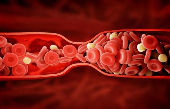 Вчені розробили спеціального робота, який очищуватиме судини від тромбів Вчені розробили спеціального робота, який очищуватиме судини від тромбів