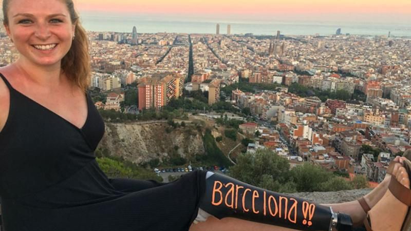 Дівчина із протезом об’їхала Європу та завела тревел-блог 