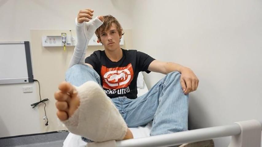 Австралієць пересадив палець з ноги на руку після виробничої травми