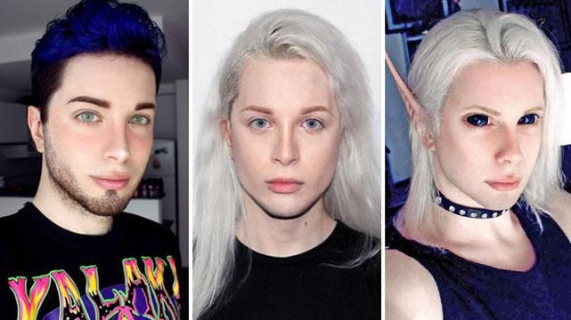 Аргентинец сделал 40 операций, чтобы стать похожим на эльфа Аргентинец сделал 40 операций, чтобы стать похожим на эльфа