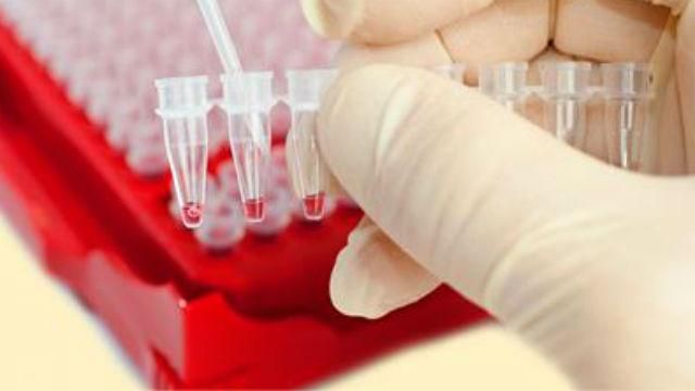 Назвали вирус, который убивает больше людей, чем ВИЧ Назвали вирус, который убивает больше людей, чем ВИЧ