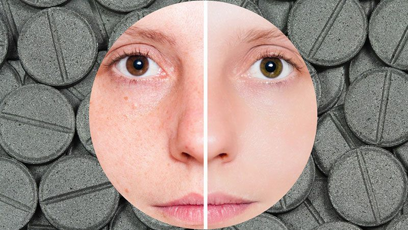 5 способов использовать активированный уголь, о которых вы могли не знать