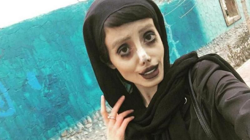 "Двійник" Анджеліни Джолі пояснила свою моторошну зовнішність "Двійник" Анджеліни Джолі пояснила свою моторошну зовнішність