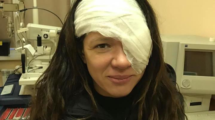 Руслана показала наслідки операції на оці