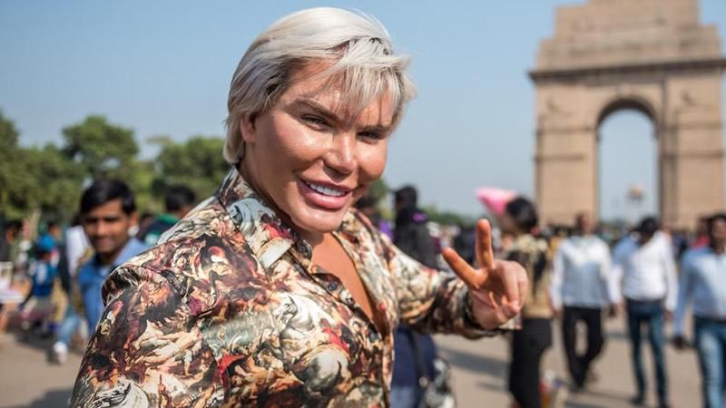 Бразильський "Кен" показав, як виглядав до десятка пластичних операцій: фото Бразильський "Кен" показав, як виглядав до десятка пластичних операцій: фото