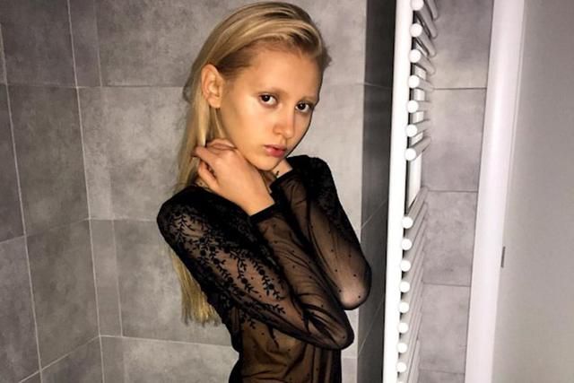 Українську модель паралізувало після страшної ДТП у США Українську модель паралізувало після страшної ДТП у США