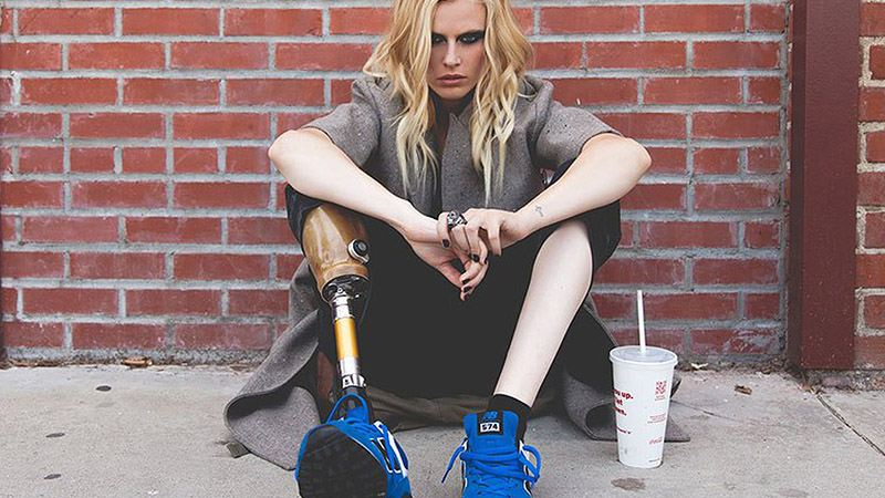 Известной модели Лорен Вассер ампутировали вторую ногу: фото