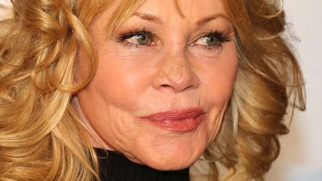 Актриса Мелані Гріффіт вперше вийшла на публіку після видалення пухлини на обличчі Актриса Мелані Гріффіт вперше вийшла на публіку після видалення пухлини на обличчі