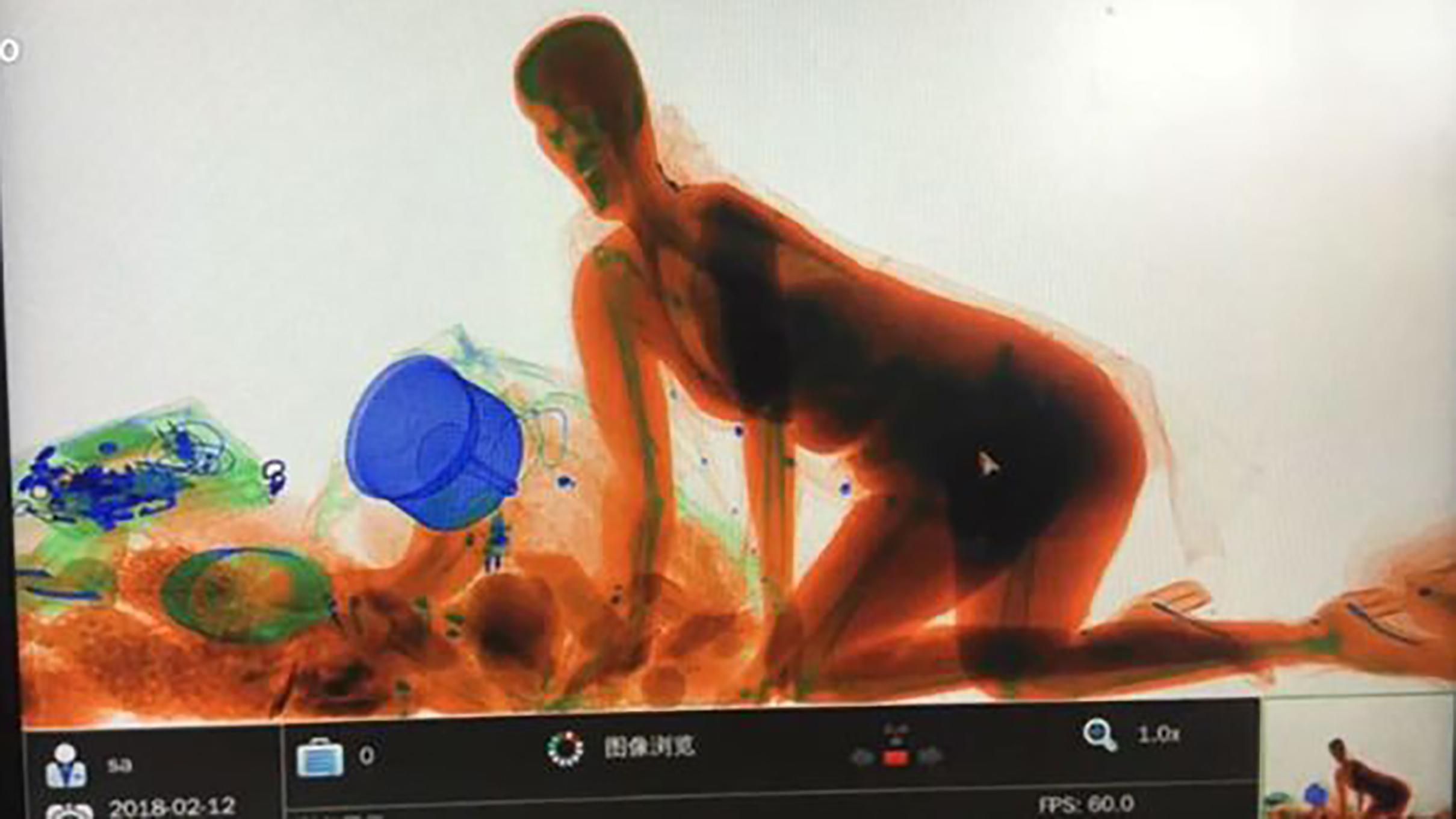 В Китае женщина залезла в сканер вслед за вещами: видео