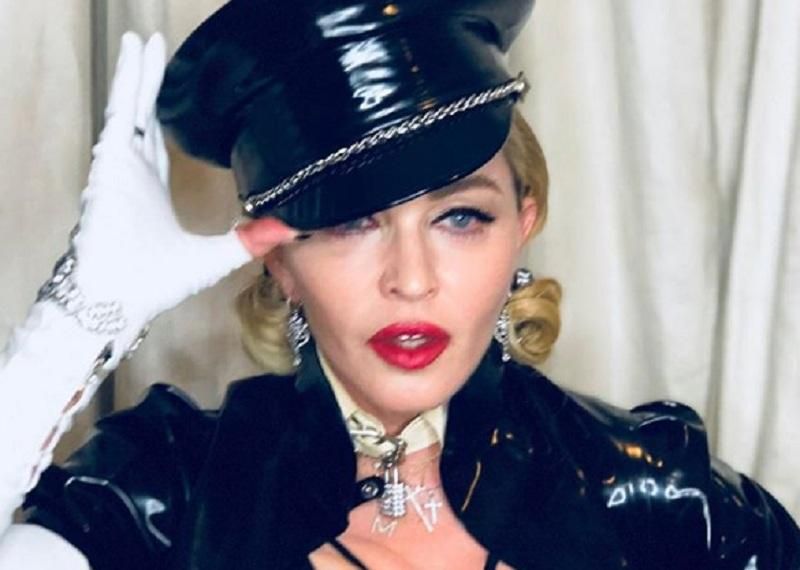 Мадонна "засвітила" груди на церемонії "Оскар": фото