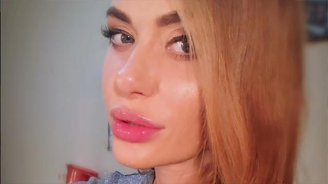 Украинская певица откровенно рассказала о своих пластических операциях Украинская певица откровенно рассказала о своих пластических операциях