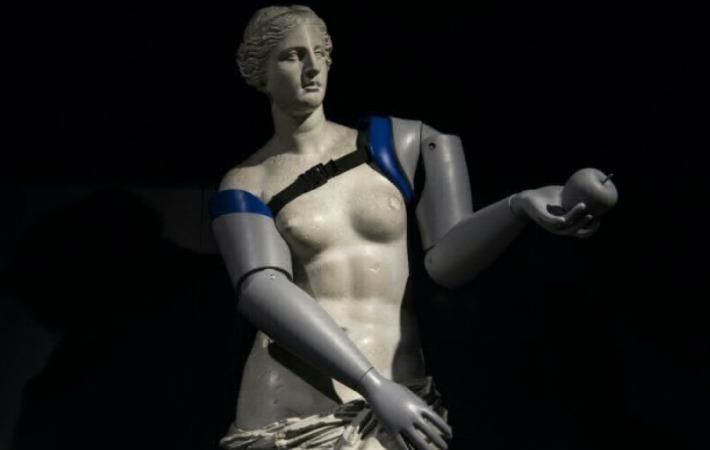 Венера Мілоська отримала нові руки – все заради благородної мети Венера Мілоська отримала нові руки – все заради благородної мети