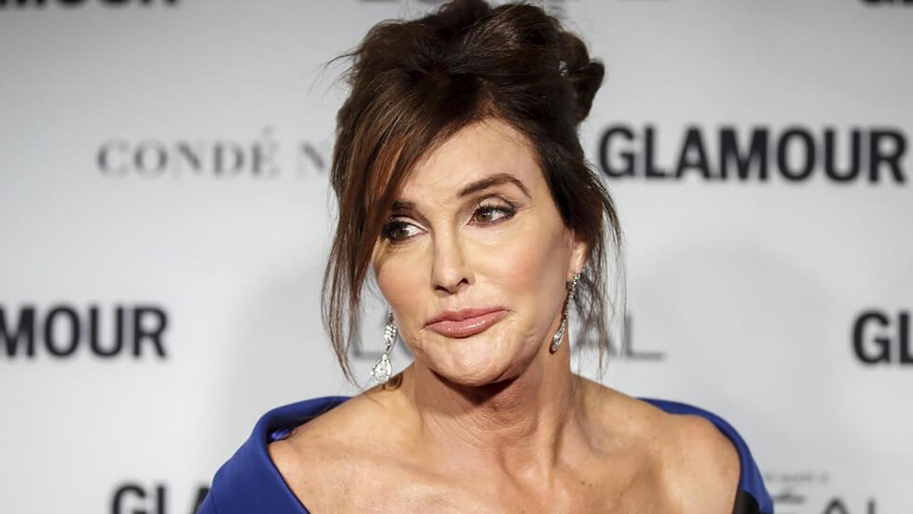 Бывший отчим Кардашян Кейтлин Дженнер выставила фото с кровавой раной