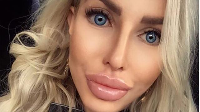 Девушка потратила огромные деньги, чтобы стать похожей на Барби: впечатляющие фото 18+