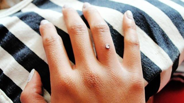 Чем опасен трендовый пирсинг на пальце