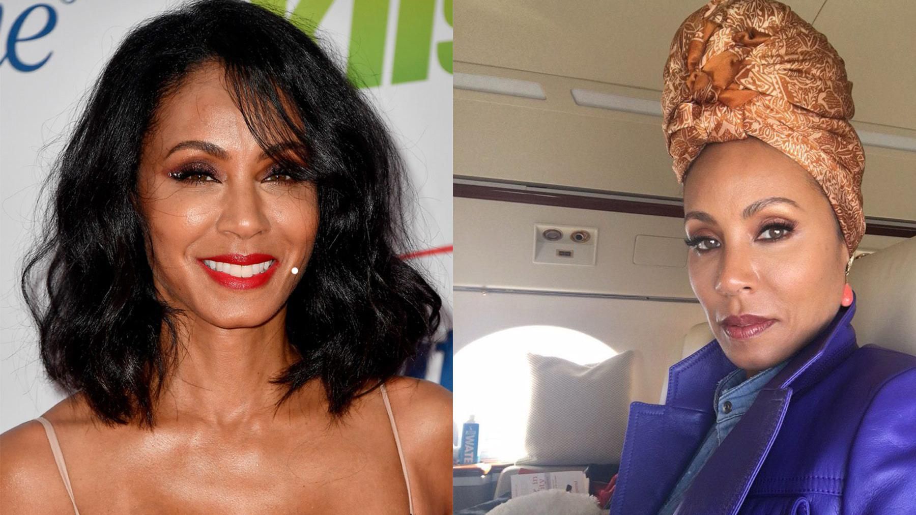 Жена Уилла Смита рассказала о редком заболевании Жена Уилла Смита рассказала о редком заболевании