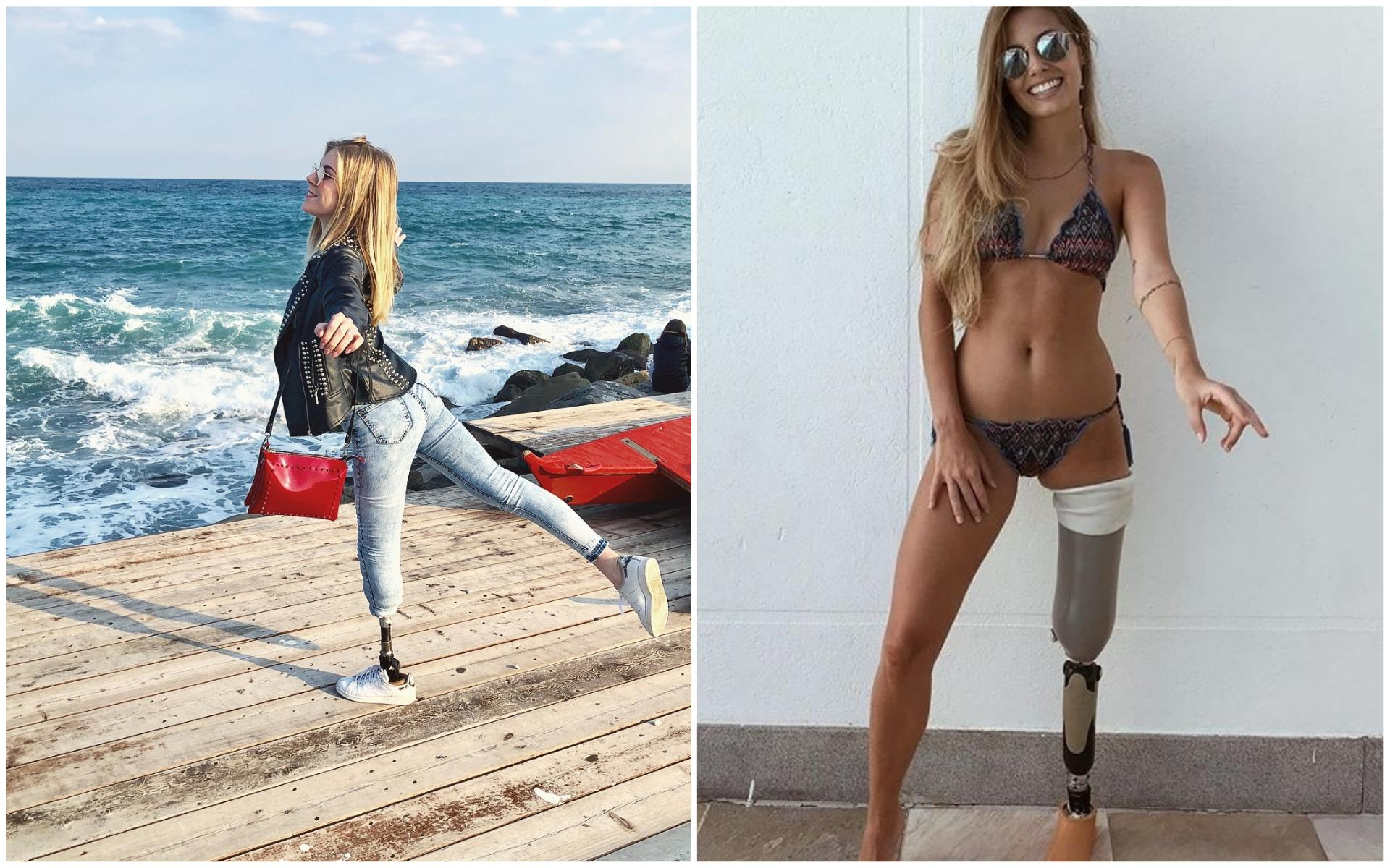 "О счастье": истории моделей с ампутированными ногами, которые покорили сети жизнерадостными фот