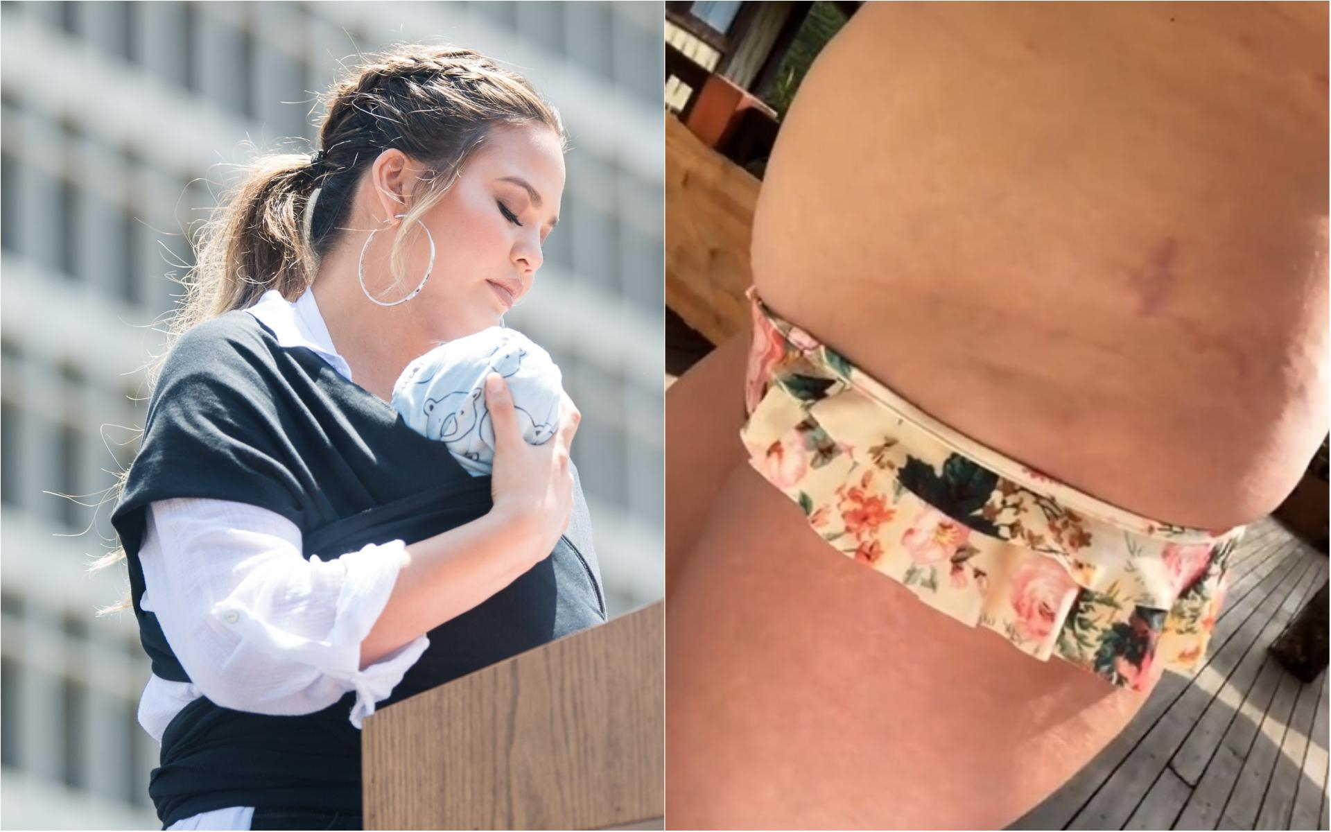 Крисси Тейген показала тело с растяжками после родов: фото