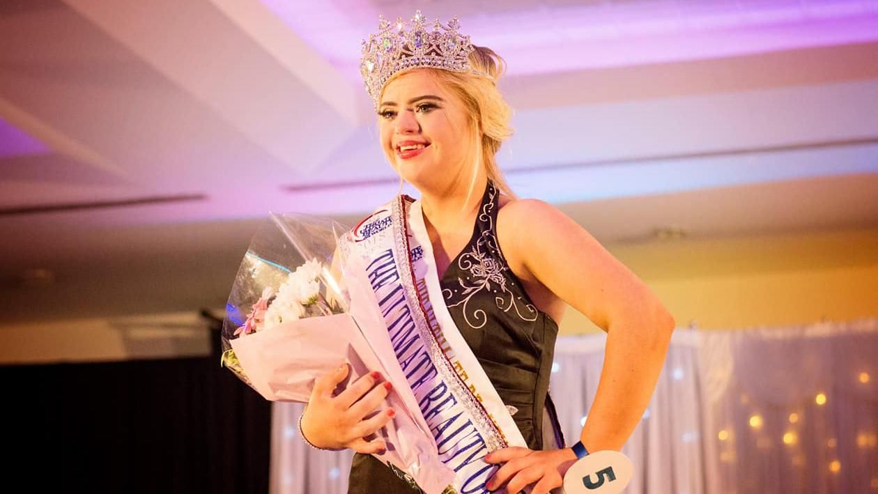 Дівчина з синдромом Дауна стала переможницею конкурсу краси Дівчина з синдромом Дауна стала переможницею конкурсу краси