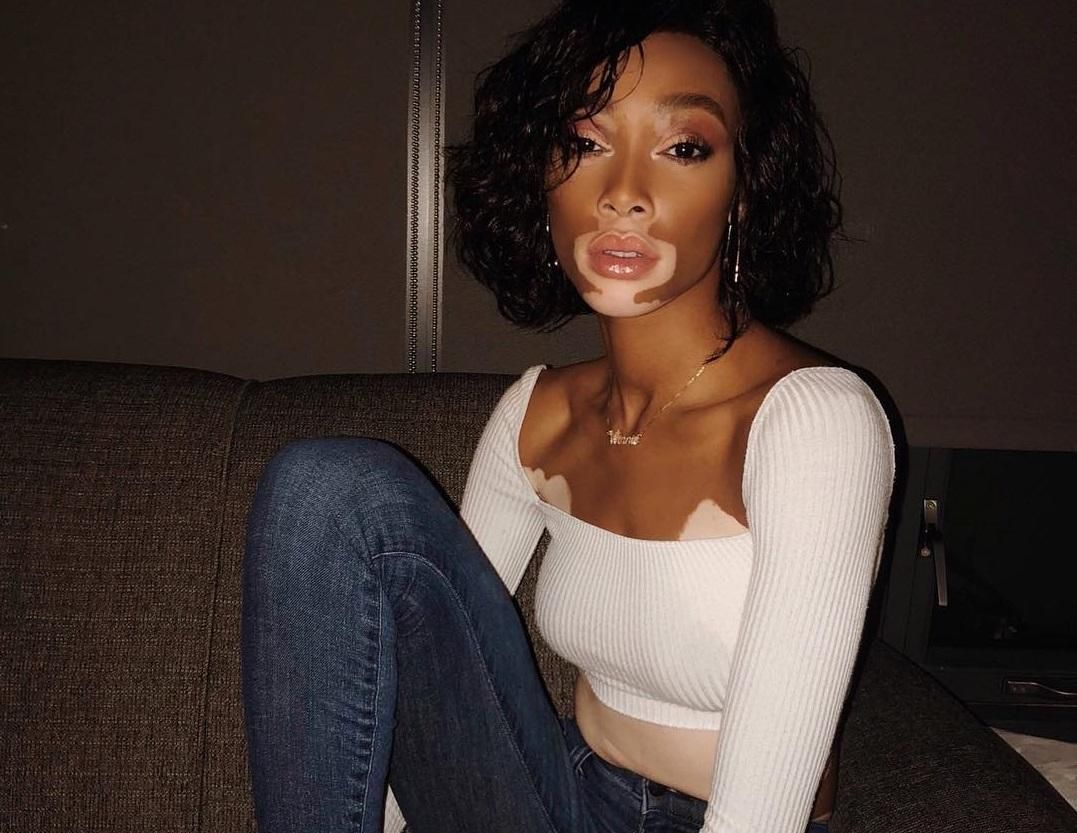 Модель з вітиліго Вінні Харлоу стала "ангелом" Victoria's Secret Модель з вітиліго Вінні Харлоу стала "ангелом" Victoria's Secret