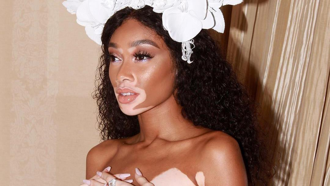 Самые сексуальные фото модели Винни Харлоу с болезнью витилиго 18+