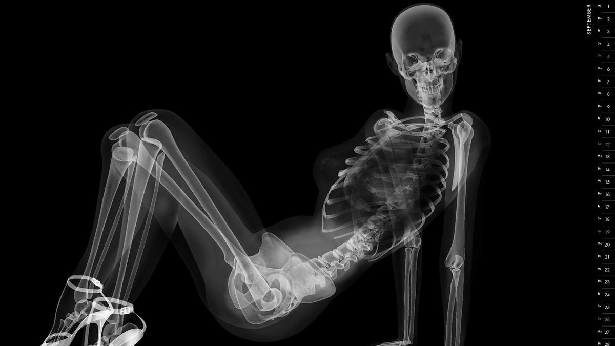 Как выглядит эротическая фотосессия на рентгеновских снимках: забавные кадры