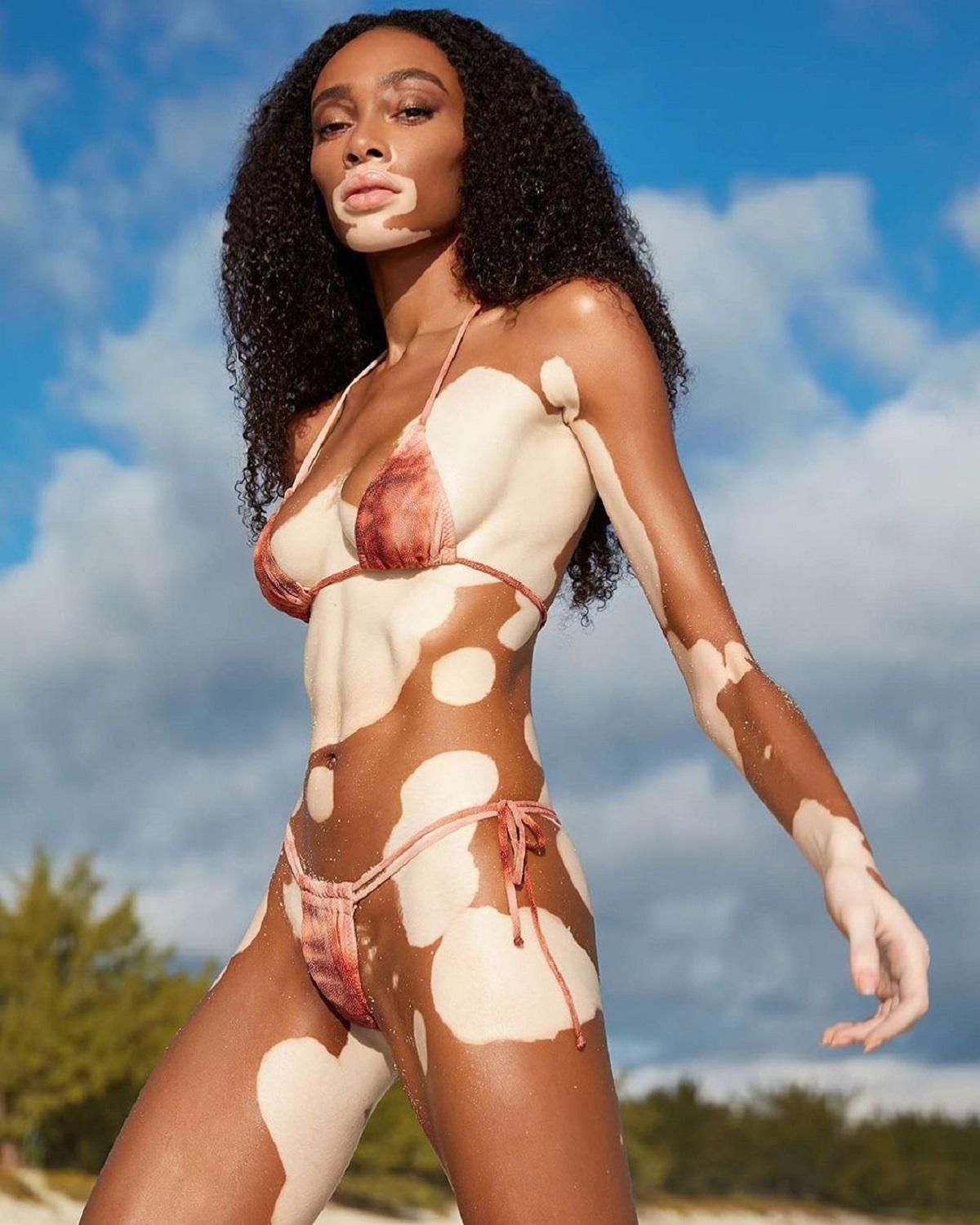 Модель с витилиго Винни Харлоу показала обнаженную грудь: соблазнительное фото