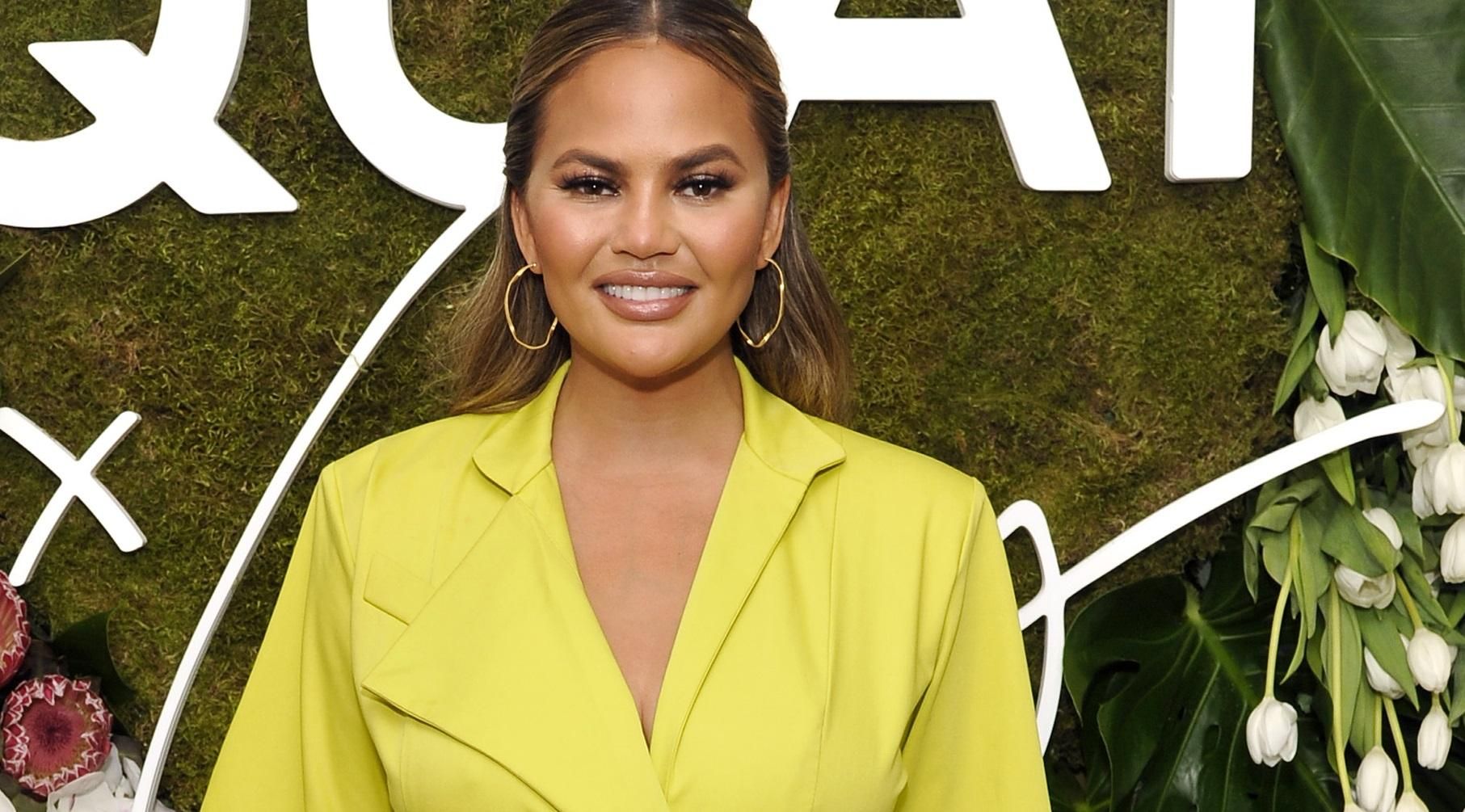 Кріссі Тейген показала набряклі губи через висотну хворобу: фото Кріссі Тейген показала набряклі губи через висотну хворобу: фото