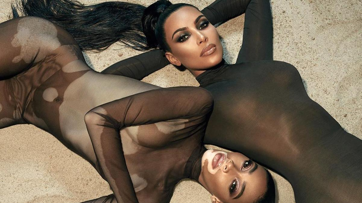 Ким Кардашян снялась в соблазнительной съемке с моделью, которая имеет болезнь витилиго