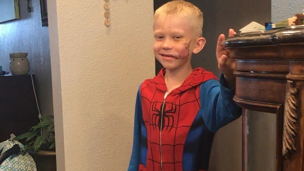 "Капітан Америка" та інші зірки відреагували на вчинок хлопчика, який врятував сестру від собаки "Капітан Америка" та інші зірки відреагували на вчинок хлопчика, який врятував сестру від собаки