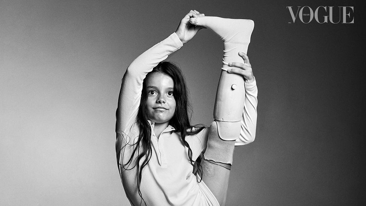Глянец Vogue снял людей с ампутациями Глянец Vogue снял людей с ампутациями